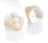 Restore Your Smile with Dental Crowns