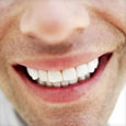牙桥补缀设计是一种治疗牙齿缺失的修复